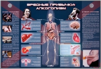 Электрифицированный стенд "Вредные привычки: алкоголизм" - «globural.ru» - Ростов-на-Дону