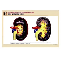 Рельефная таблица "Почка. Фронтальный разрез" (формат А1, матовое ламинир.) - «globural.ru» - Ростов-на-Дону